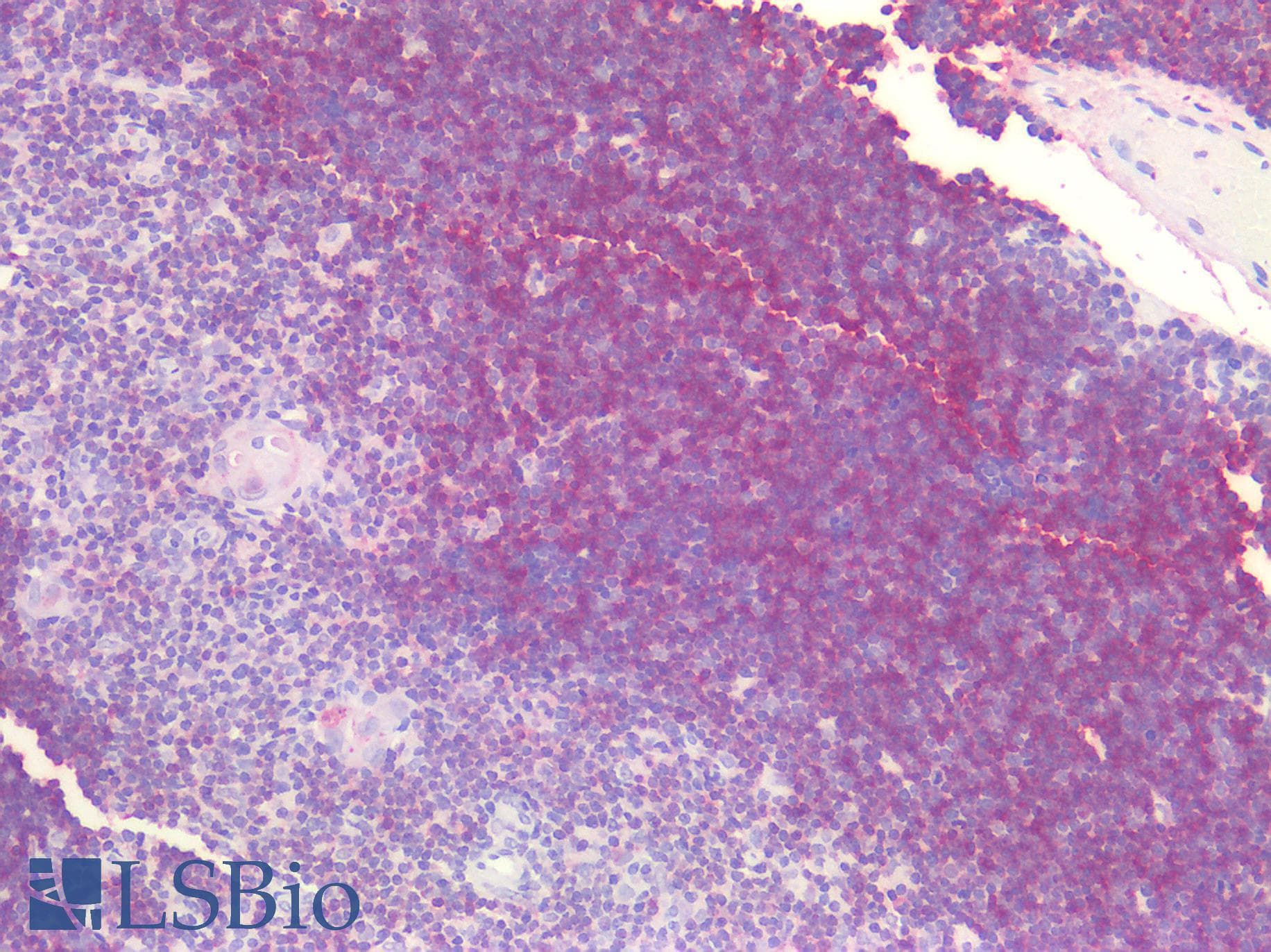 PathPlus™ CD38 Antibody (clone 6E12D4A12)