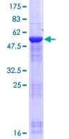 Human KRT18P55 Protein (Recombinant GST)