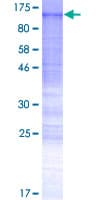 Human RSBN1L Protein (Recombinant GST)