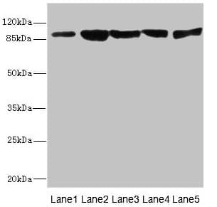 DSC2 / Desmocollin 2 Antibody