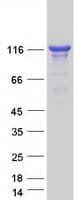 Human UNC13D Protein (Recombinant Myc-DDK (Flag))