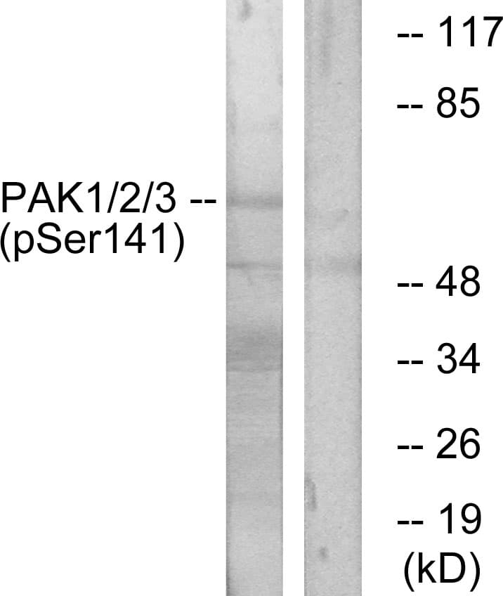 Polyclonal Rabbit anti-Human PAK1 + PAK2 + PAK3 Antibody (phospho-Ser144/Ser141/Ser139, IHC, WB)