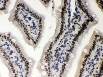 CSNK1A1 / CK1 Alpha Antibody