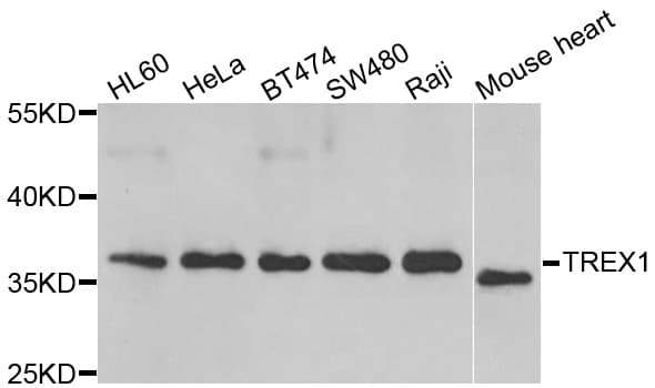 TREX1 Antibody