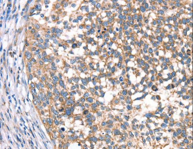 Polyclonal Rabbit anti-Human DECR1 Antibody (IHC, WB)
