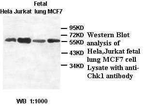 IHC-plus™ CHEK1 / CHK1 Antibody