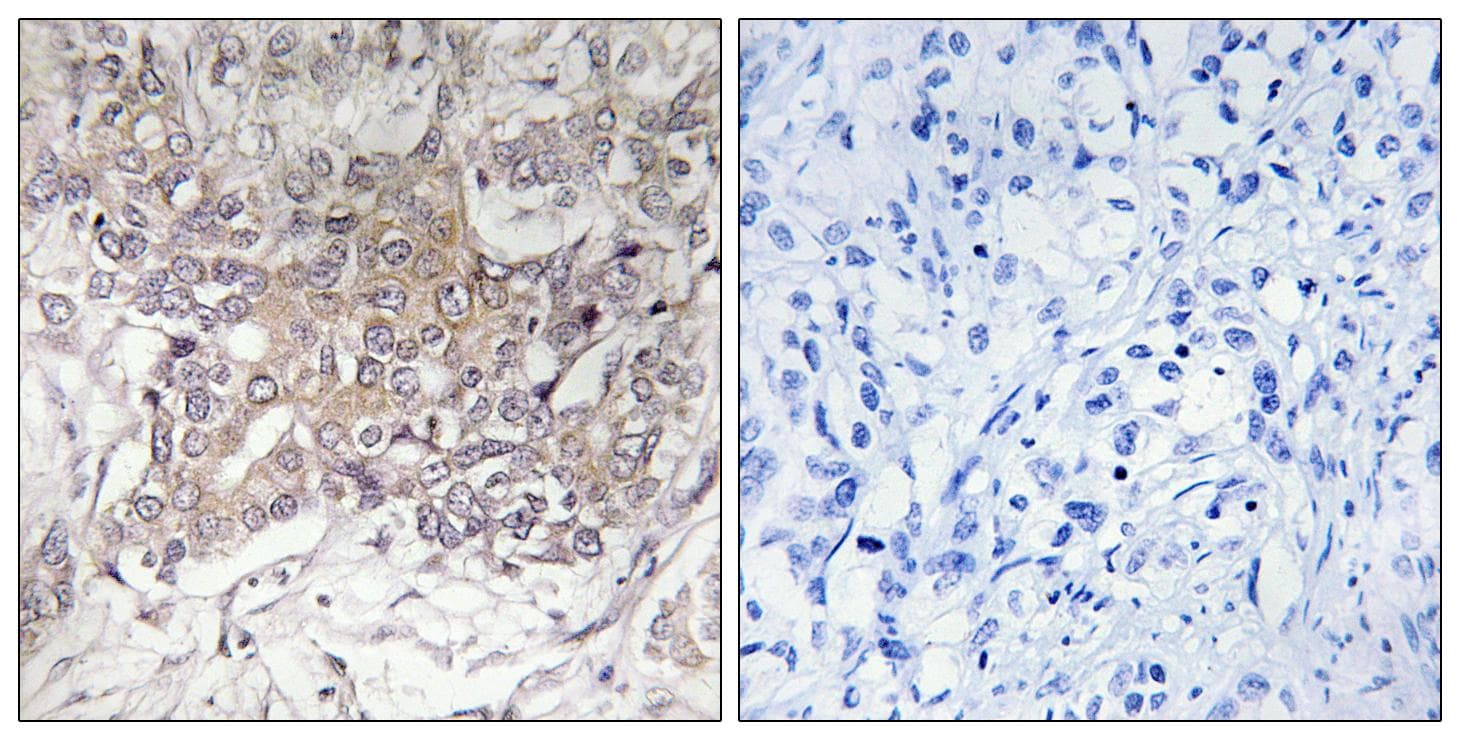 Polyclonal Rabbit anti-Human GCNT3 Antibody (IHC, IF)