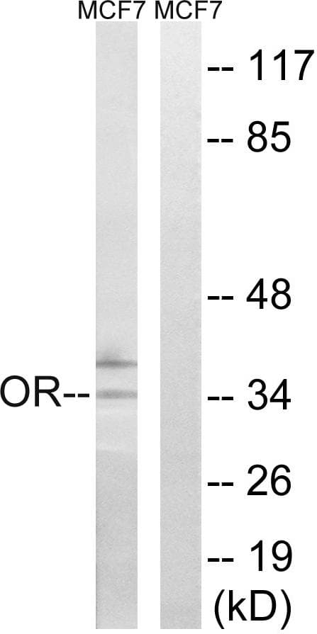 Polyclonal Rabbit anti-Human OR51H1 Antibody (WB)