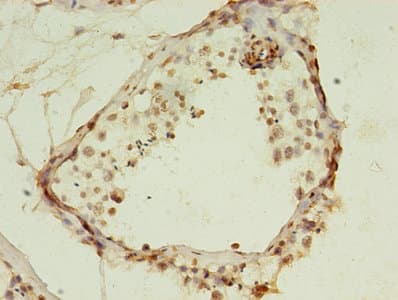 HIST1H2AG Antibody