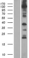 ANO8 / TMEM16H Protein (Over-Expression Lysate Myc-DDK (Flag))
