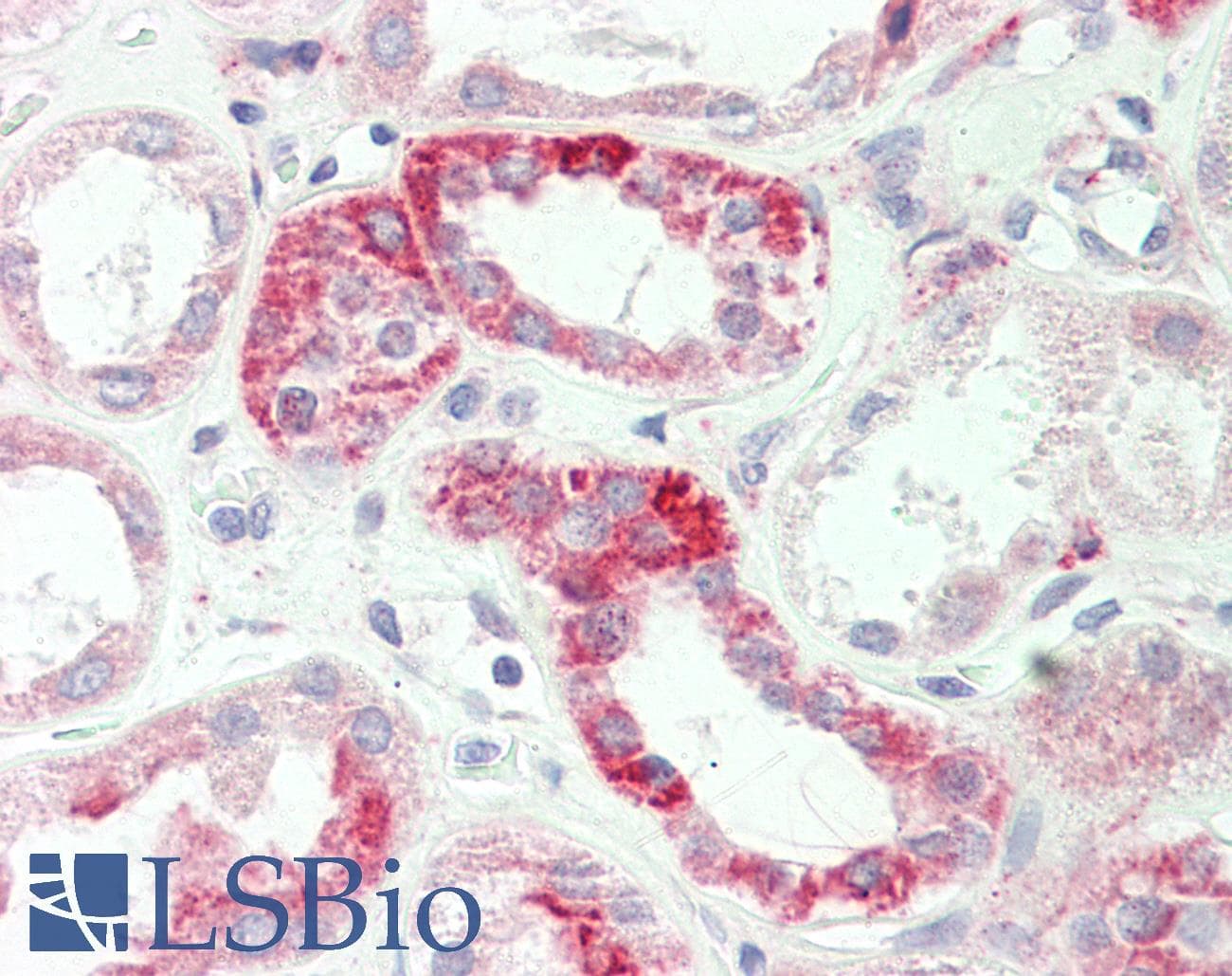 IHC-plus™ ADORA1 / Adenosine A1 Receptor Antibody (Asp326)