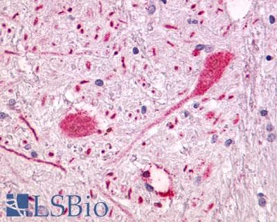 PathPlus™ Polyclonal Rabbit anti-Human GPR55 Antibody (Extracellular Domain, IHC)
