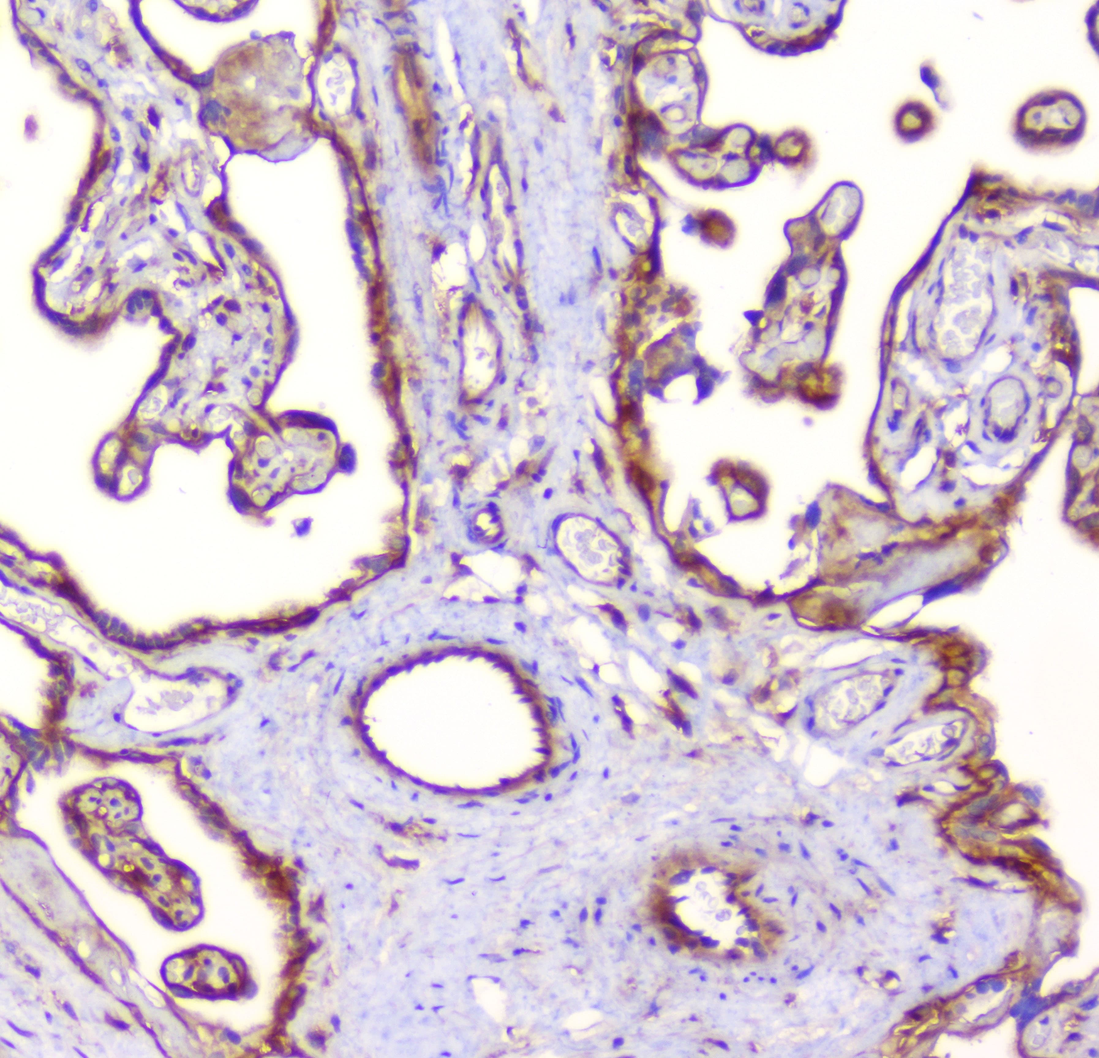 Polyclonal Rabbit anti-Human RP2 Antibody (IHC, WB)