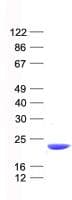 Human NAT5 / NAA20 Protein (Recombinant His, N-Terminal)