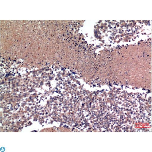 Monoclonal Mouse anti-Human CCNB1 / Cyclin B1 Antibody (IHC)