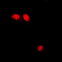 TNNC1 / Cardiac Troponin C Antibody