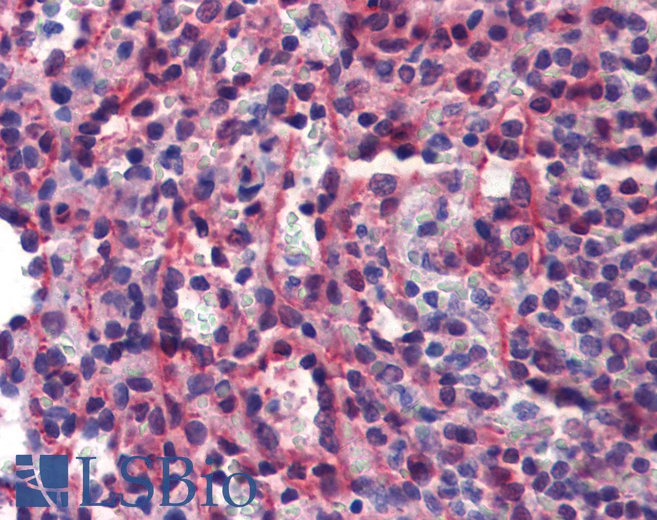 IHC-plus™ Monoclonal Mouse anti-Human CASP7 / Caspase 7 Antibody (clone 7-1-11, IHC, WB)