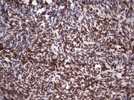 CSNK1E / CK1 Epsilon Antibody (aa153-416, clone OTI5D4)