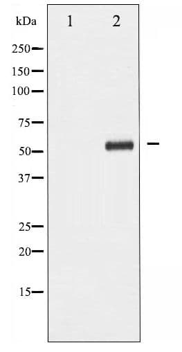 Polyclonal Rabbit anti-Human PDCD4 Antibody (phospho-Ser67, WB)
