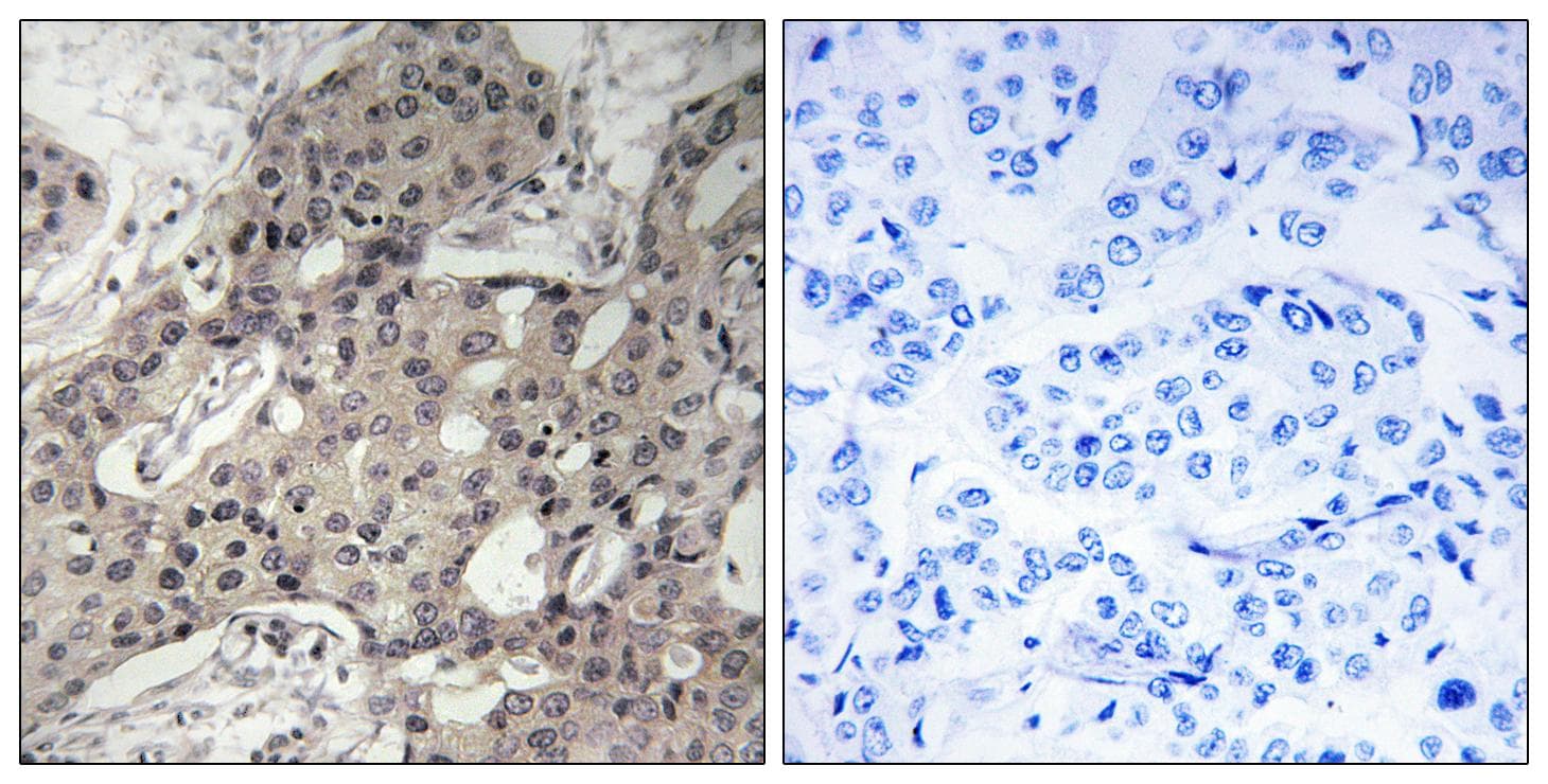 RPL3 / Ribosomal Protein L3 Antibody