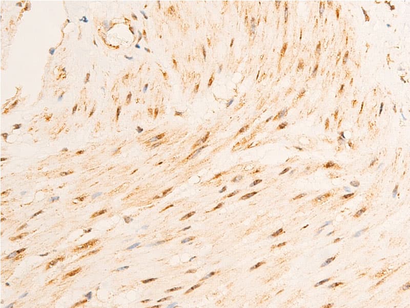 GSK3B / GSK3 Beta Antibody (phospho-Ser9)