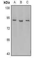 MPO / Myeloperoxidase Antibody