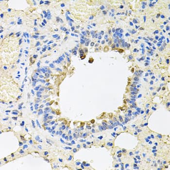 SKAP2 / SCAP2 Antibody