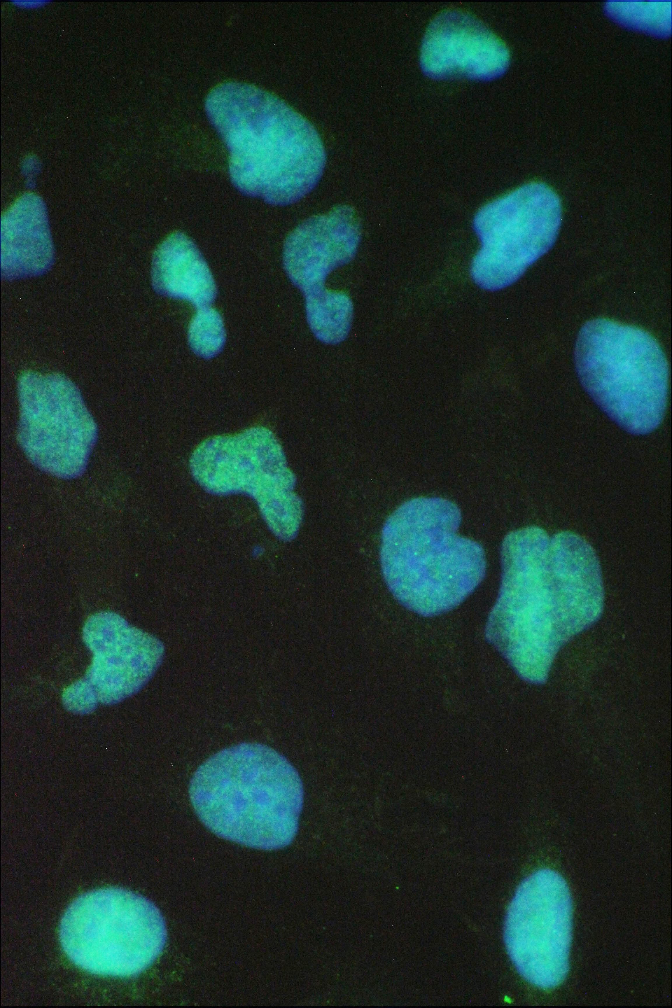 Polyclonal Rabbit anti-Human SMARCA4 / BRG1 Antibody (IHC, WB)