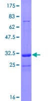 Human TRIM36 Protein (Recombinant GST)