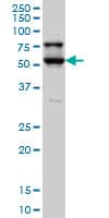 IHC-plus™ Monoclonal Mouse anti-Human DRAK1 / STK17A Antibody (clone 4D12, IHC, WB)