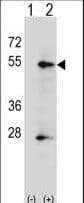 Polyclonal Rabbit anti-Human PLAP / Alkaline Phosphatase Antibody (aa56-83, IHC, WB)