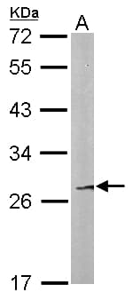 Polyclonal Rabbit anti-Human FAM122B Antibody (aa1-145, WB)