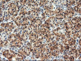 AGPAT5 Antibody (clone OTI2C4)