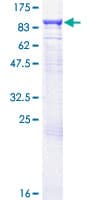 Human GUCY1A1 / GUCY1A3 Protein (Recombinant GST)