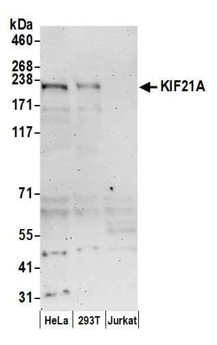 KIF21A Antibody (aa1-50)