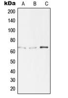 TBX15+18 Antibody (Internal)