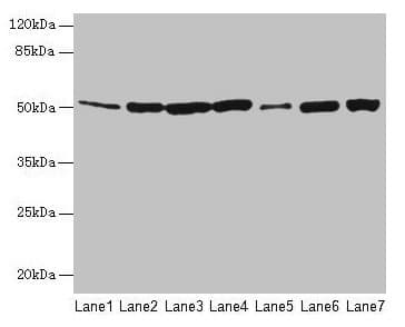 FH / Fumarase / MCL Antibody