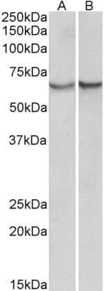 IHC-plus™ Alpha-1-Antichymotrypsin Antibody (aa222-236)