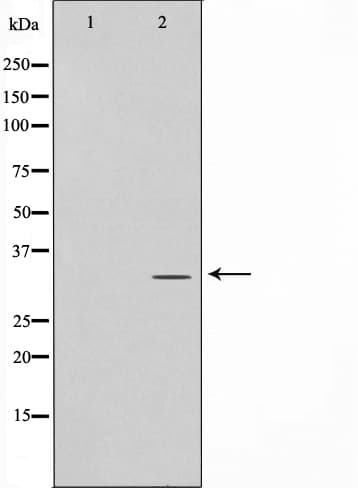 ELOVL1 Antibody