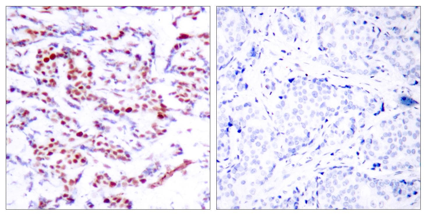 ATF2 Antibody (phospho-Ser112 or 94)