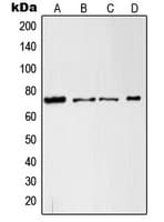 RAF1 / RAF Antibody (Internal)