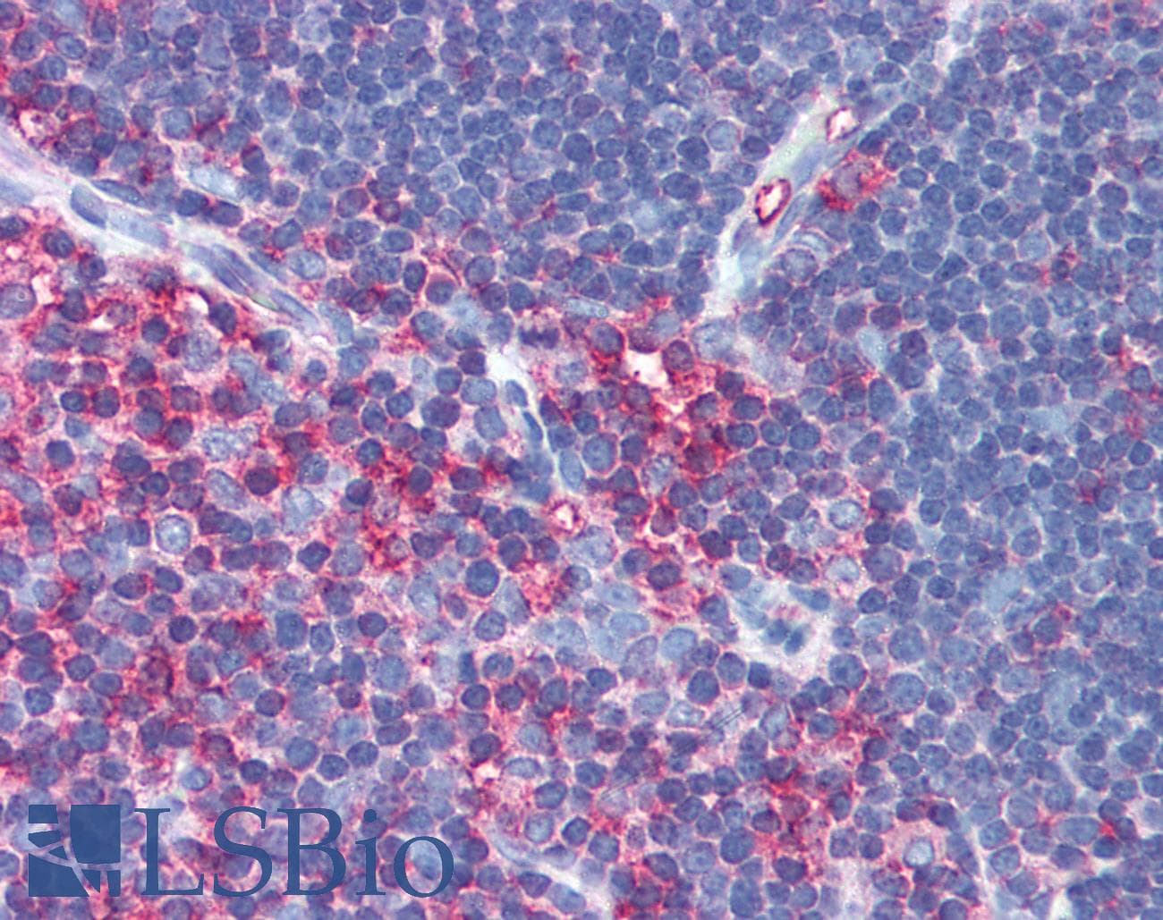 IHC-plus™ MSN / Moesin Antibody