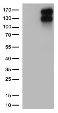 LDLR / LDL Receptor Antibody (clone OTI8D12)