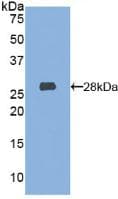 Mouse HEXA Protein (Recombinant His, N-Terminal)