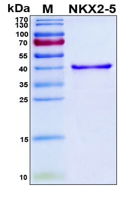 Human NKX2-5 Protein (Recombinant 6His, N-terminus)