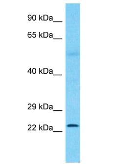CRYBB1 Antibody (aa93-142)