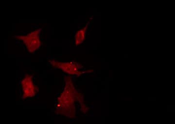 ZNF174 Antibody