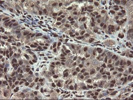 Mannose Phosphate Isomerase Antibody (clone OTI4G7)