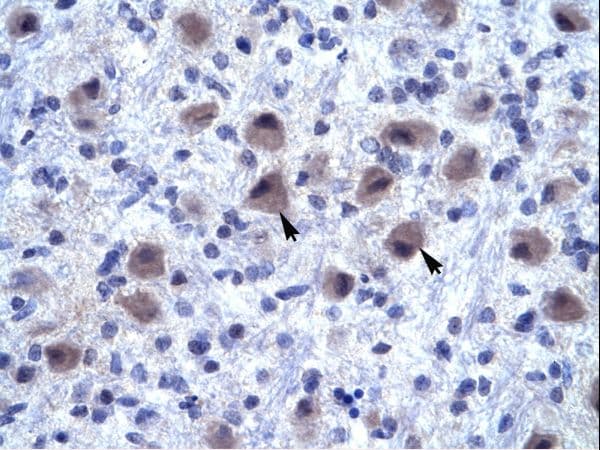 RNF141 Antibody (aa96-145)