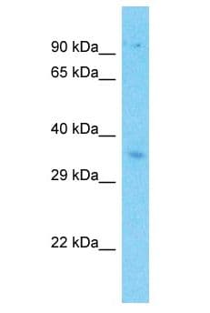 Polyclonal Rabbit anti-Human STRN3 Antibody (aa281-330, WB)